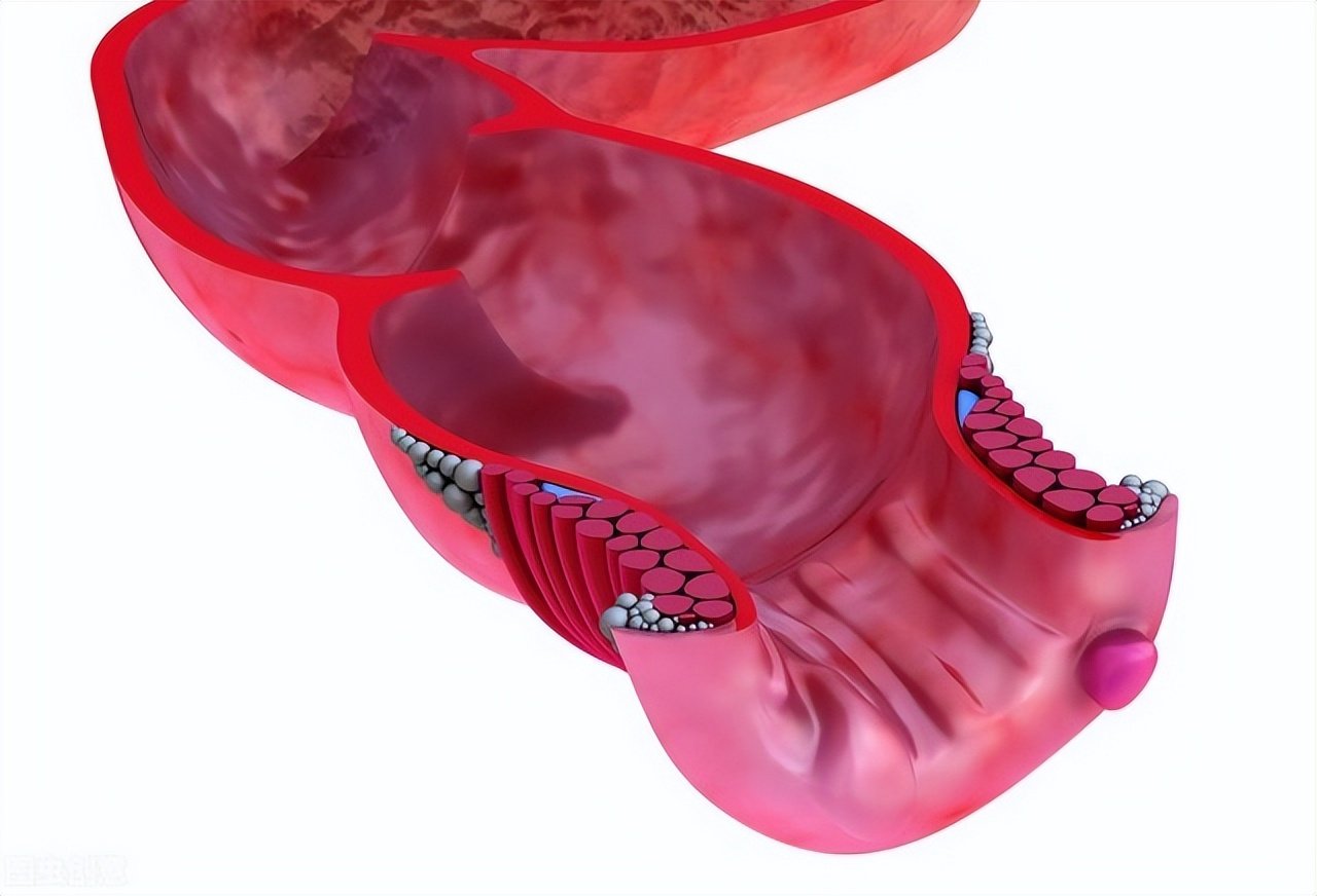 痔疮手术后出血一般持续多长时间,做痔疮手术后有大便怎么办