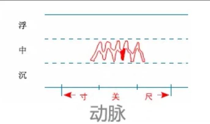 中医28脉诊歌诀及示意图,中医28脉全部脉象图解