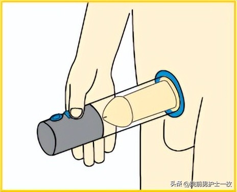 世界男性健康日健康误区,男性健康日科普先行