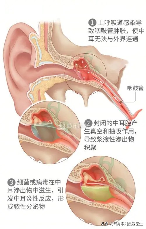 耳科知识科普针对老人图文,耳科知识科普