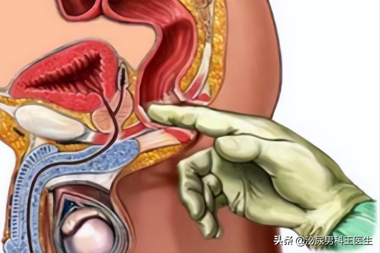 前列腺癌发现就是晚期？叶定伟教授：50岁以上最好每年检查一次