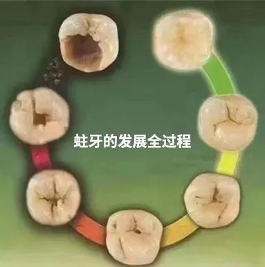 牙掉了补牙怎么补视频全过程,补牙是把牙全部拔掉还是直接补