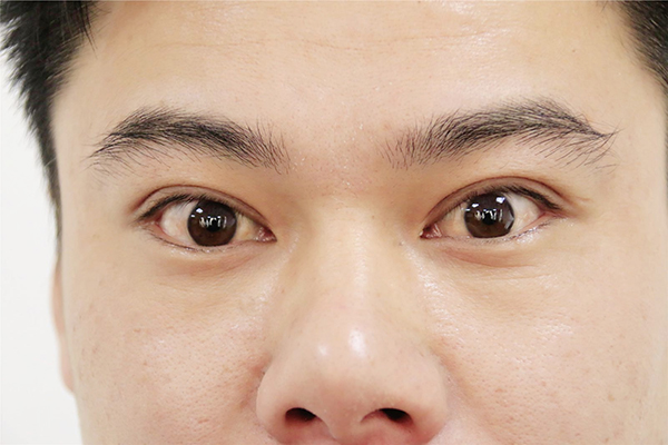 如果身体缺乏维生素b12有哪些反应,如果身体缺少维生素d会怎样