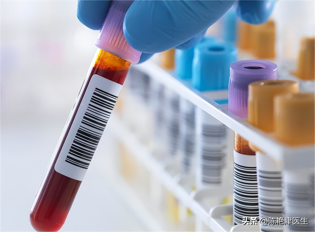 体检查出有肾结石要注意什么,体检有肾结石应该怎么处理