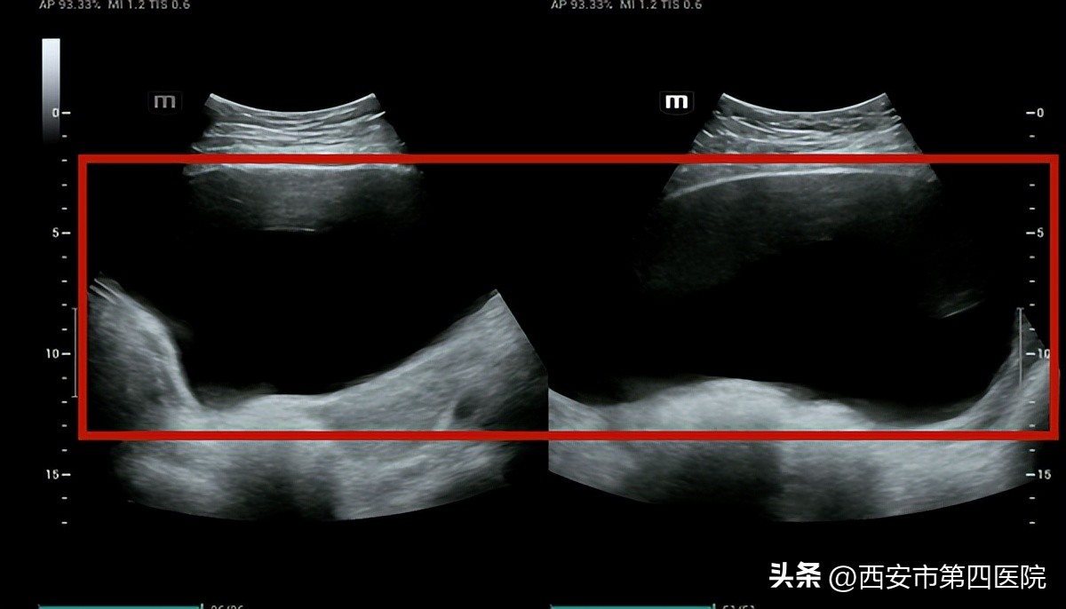 全民素养提升v计划,全民素养提升