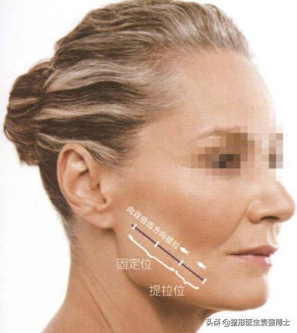 脸下垂松弛提升最好的办法,55岁脸部松弛下垂做什么锻炼紧致