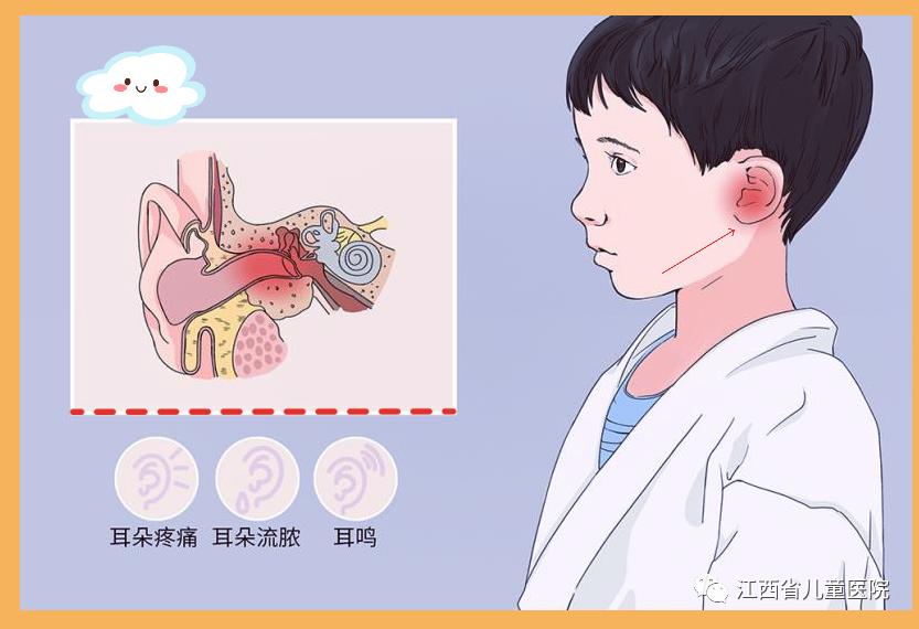 宝宝半夜突发耳痛警惕急性中耳炎,小孩半夜说耳朵疼是不是吓到了