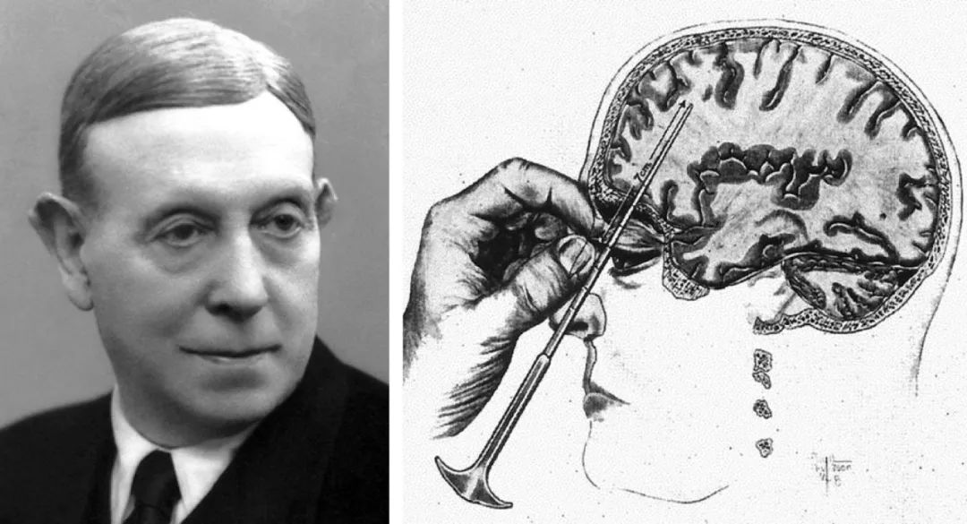 诺奖的最大耻辱,诺奖的真相是什么