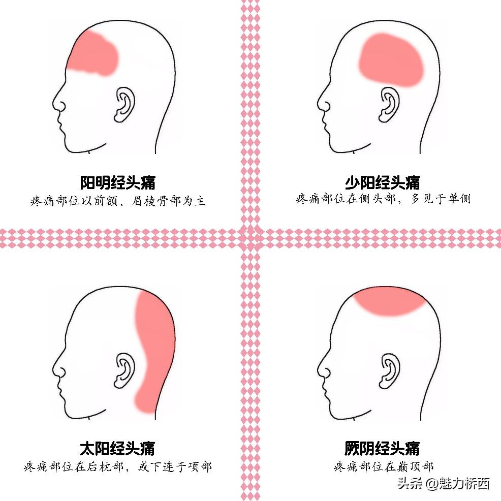 阳康之后头痛怎么办,阳康之后一直头疼是怎么回事