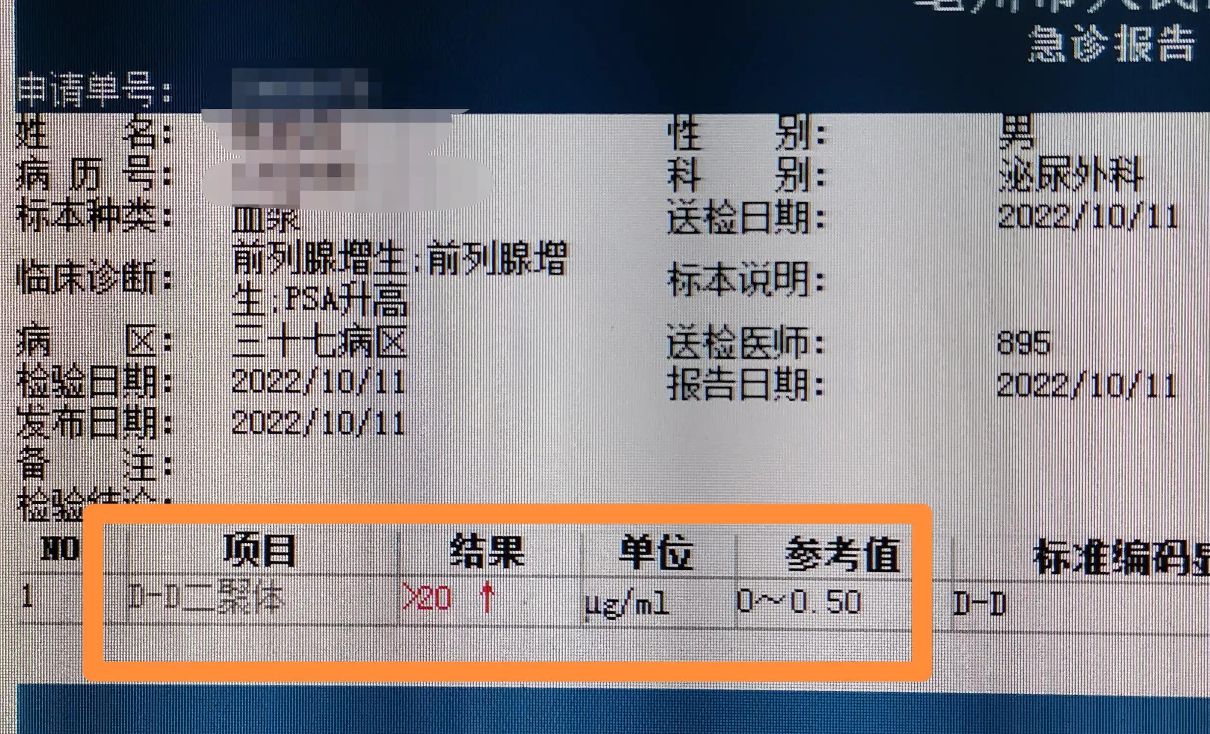 前列腺增生手术50天尿频非常重,前列腺增生手术7天后伤口出血