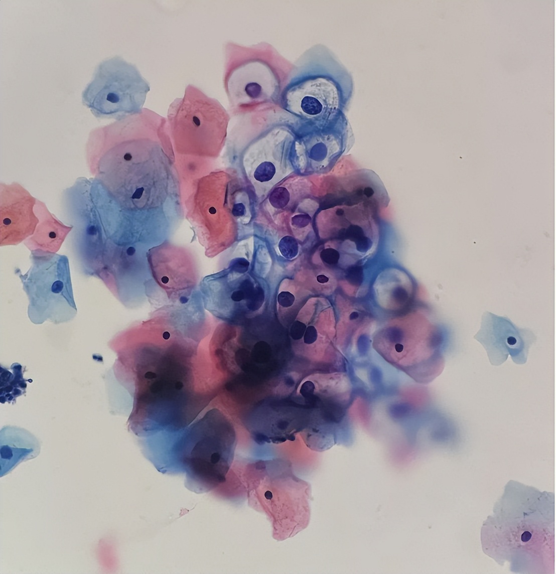 宫颈hpv感染最新指南,掌健识健康百科