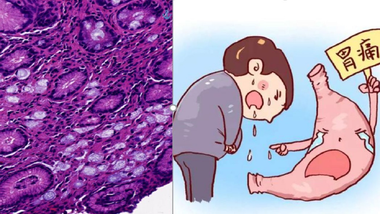 上了年纪也要注意身体,上了年龄身体需要体检