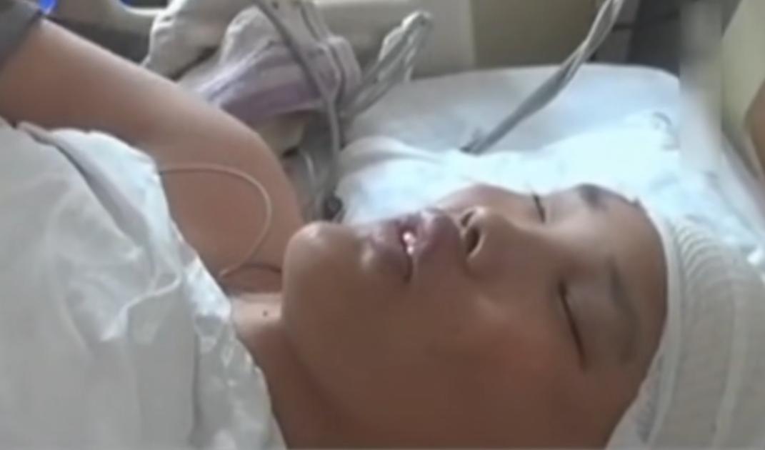 男子身患巨人症身高竟有两米四二,外国夫妇生了巨人症的孩子