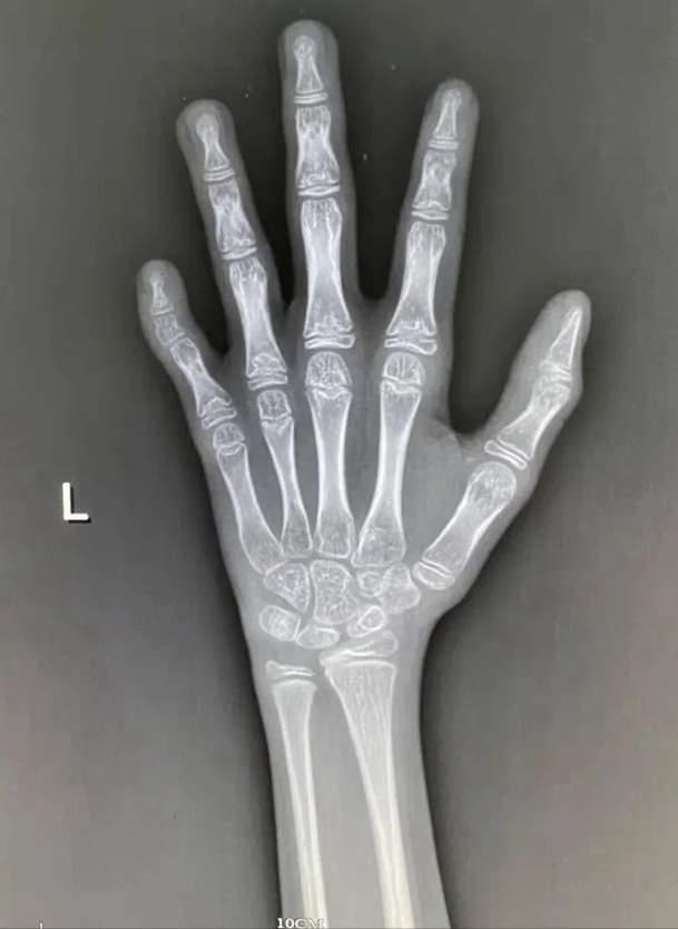 男孩女孩的青春期分别从几岁开始,男孩几岁开始进入青春期早期表现