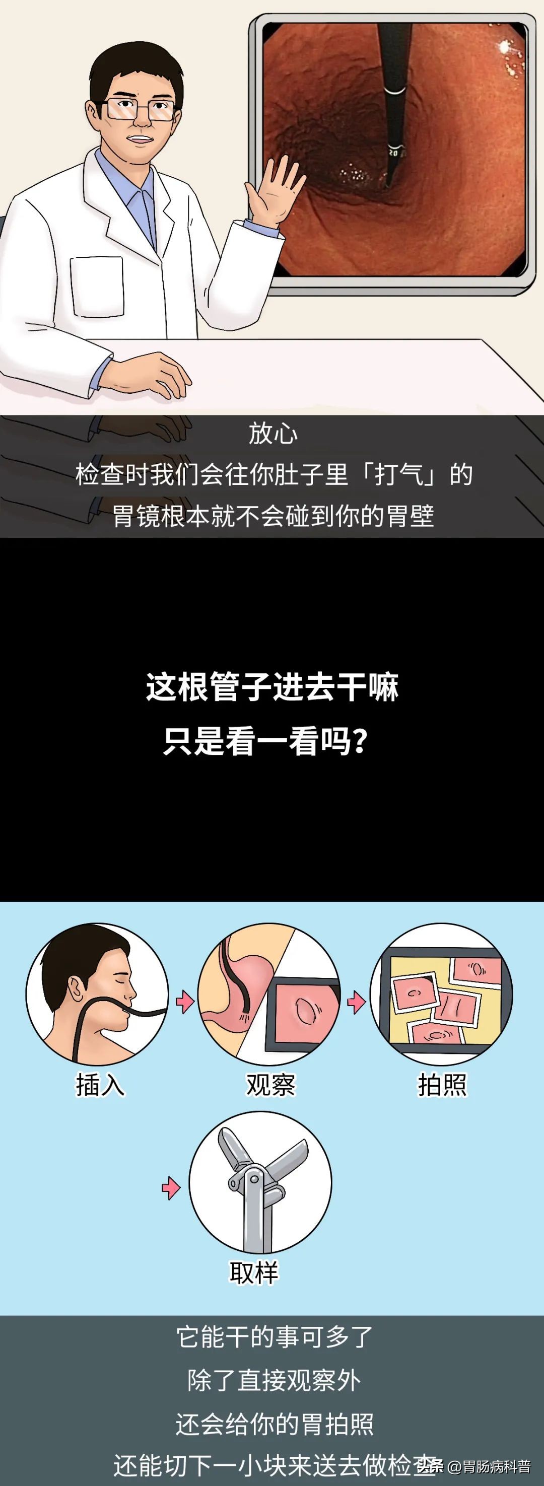 胃镜怎么做的全过程示意图,胃镜检查视频第一视角了解