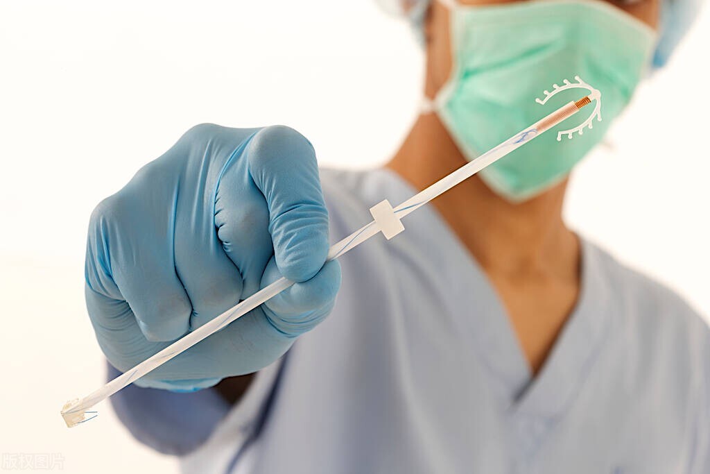 女性上环的全过程，过程让人胆寒，别害羞，男女都该好好看看！