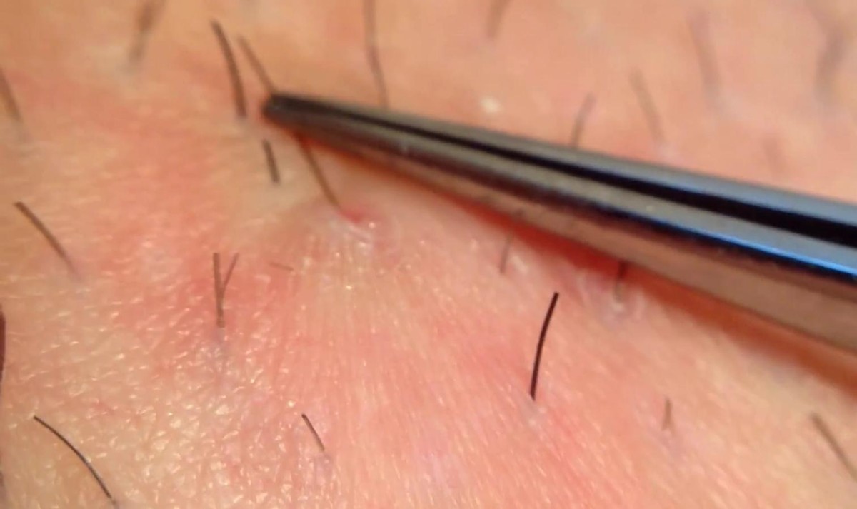 女性身上毛发旺盛什么原因呢,女性身上毛发旺盛什么原因