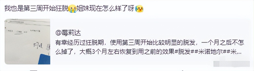 米诺地尔狂脱期前后对比,亲身经历米诺地尔的狂脱期