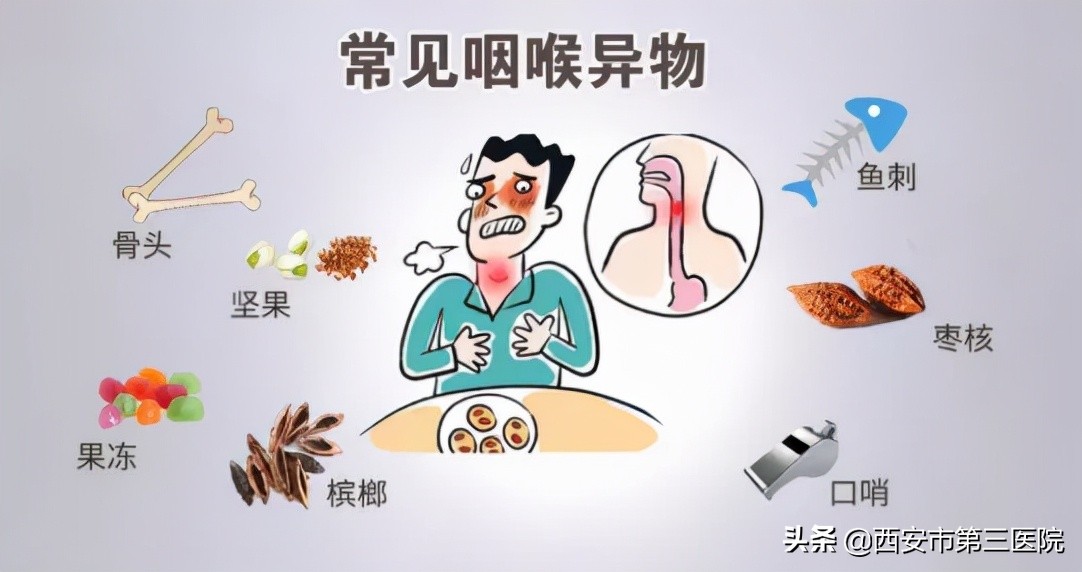 耳鼻喉科新冠疫情感染防控,耳鼻喉新冠肺炎防控措施