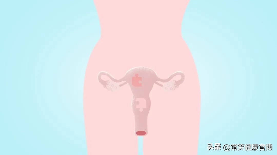 第一天剖腹产第二胎顺产的条件,剖腹产后一年怀孕可以顺产么