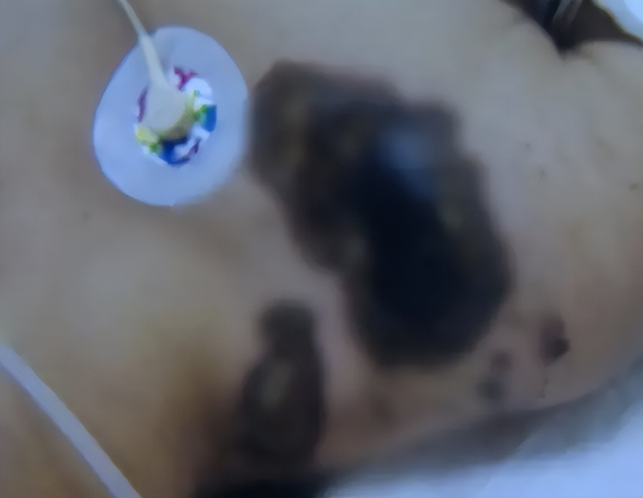 苹果充电被电到人要截肢,买iphone遭电击