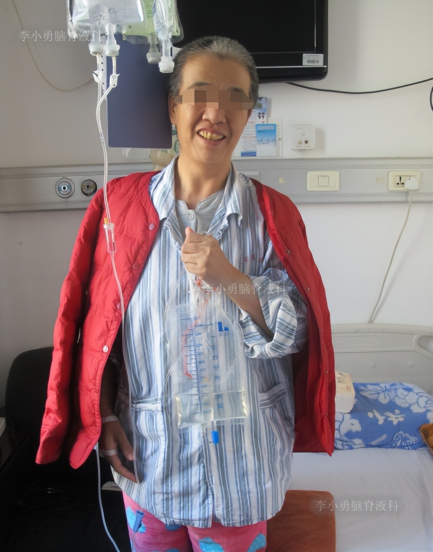 脑积水手术后4天还呕吐怎么回事,脑积水分流术后一直腹部疼痛