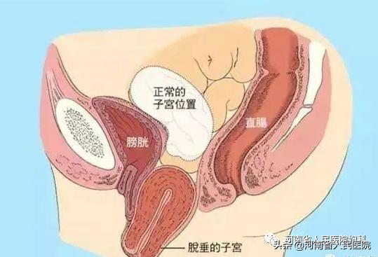 80后的难言之隐,难言之隐第十二集