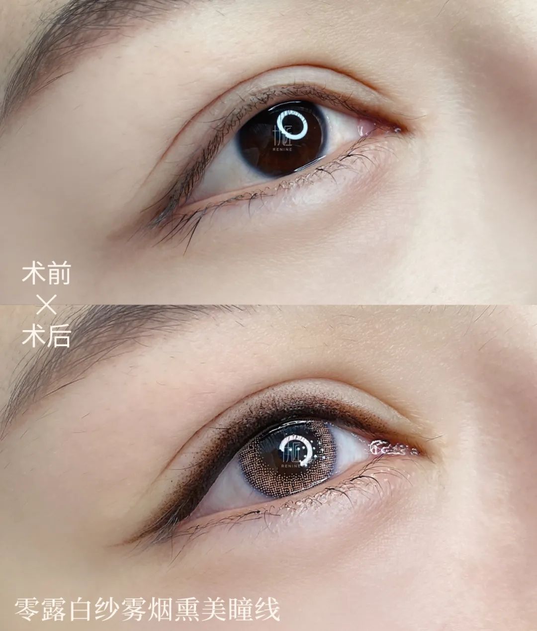 美瞳戴起来不痛吗,做美瞳线用什么舒缓乳不痛