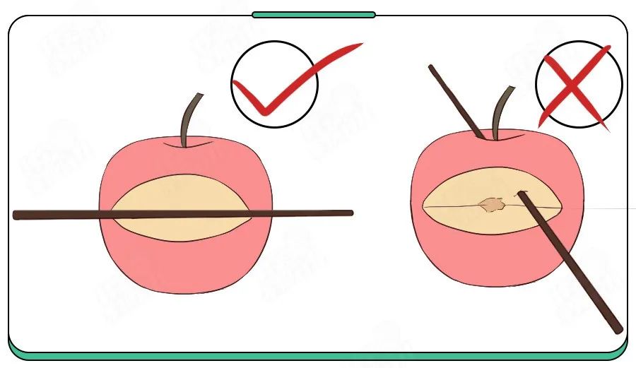 三岁女童玩筷子导致双手被锯,四岁女童不锈钢筷子切掉9根手指