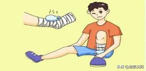 运动损伤常见科普知识,健康科普堂运动应避免的十大误区