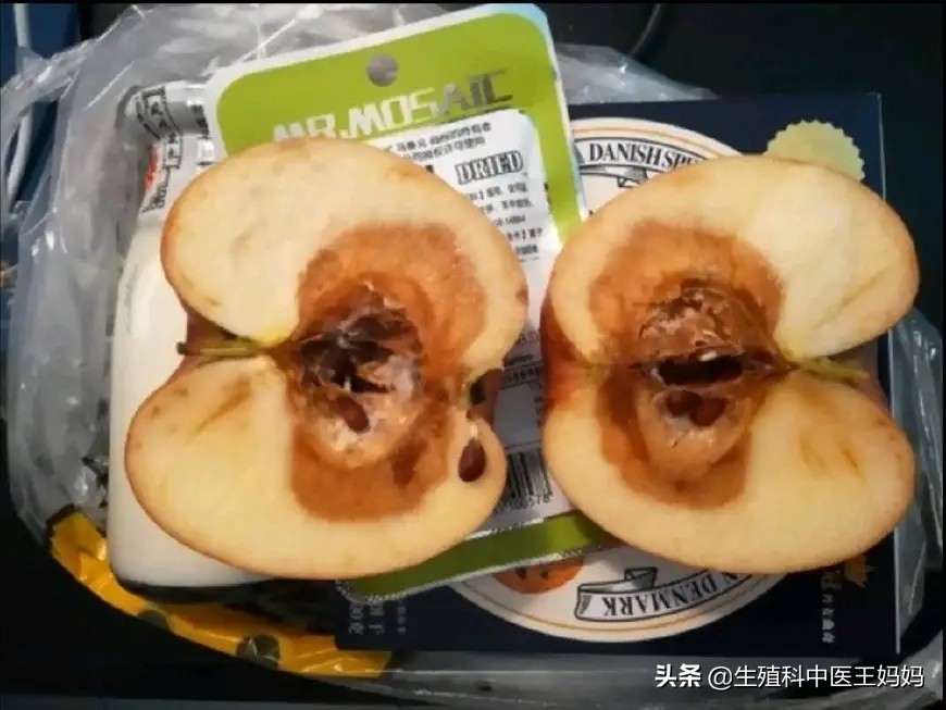 女子宫颈糜烂要不要紧,女子被医院切掉子宫