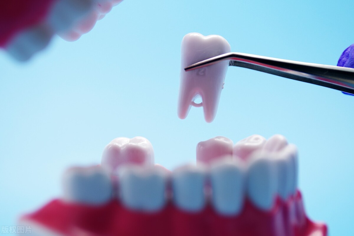 重庆口腔医院种植牙降价,陕西省口腔种植服务新政策解读