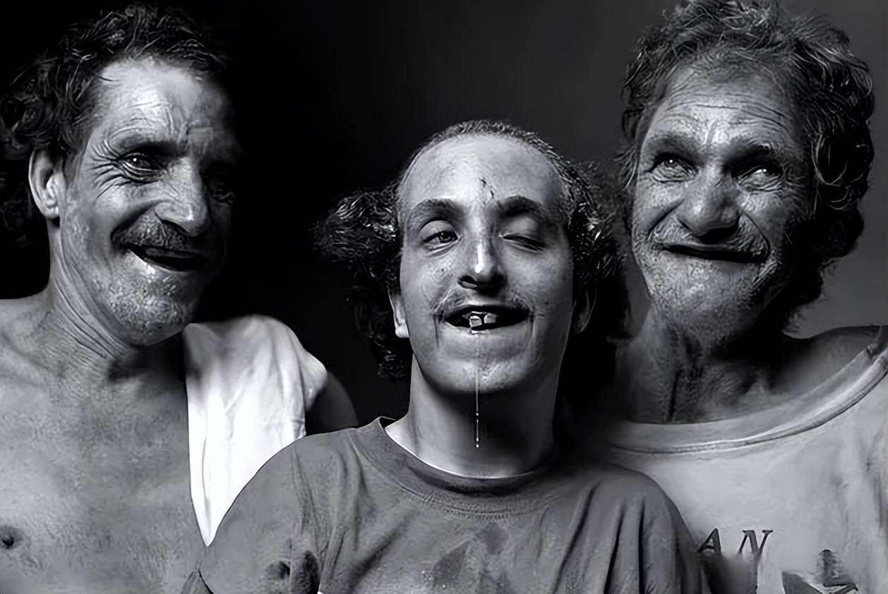 美国家族*伦乱**三代：*亲近**结合导致后代残障，无法说话只能犬吠