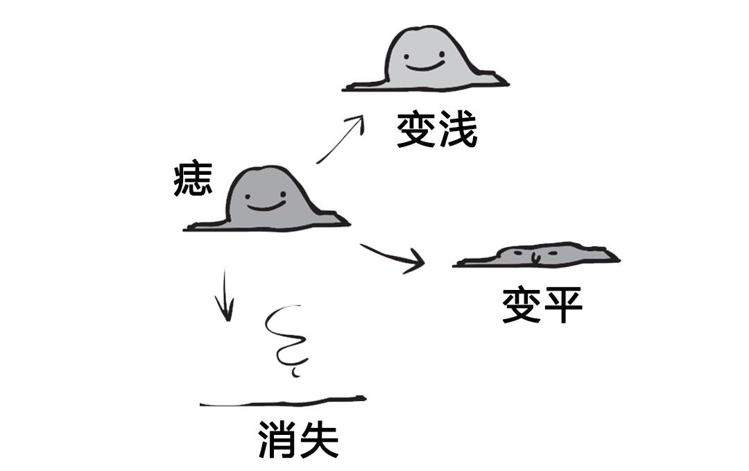 黑痣和黑色素沉着有何区别,什么样的黑痣要警惕可能会恶变