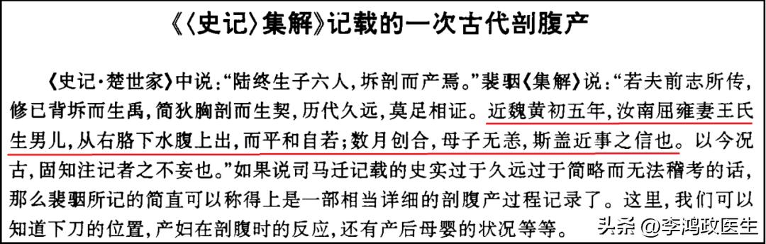鍓栬吂浜х暀涓嬫墜鏈垁,鍓栬吂浜ч仐鐣欐墜鏈垁