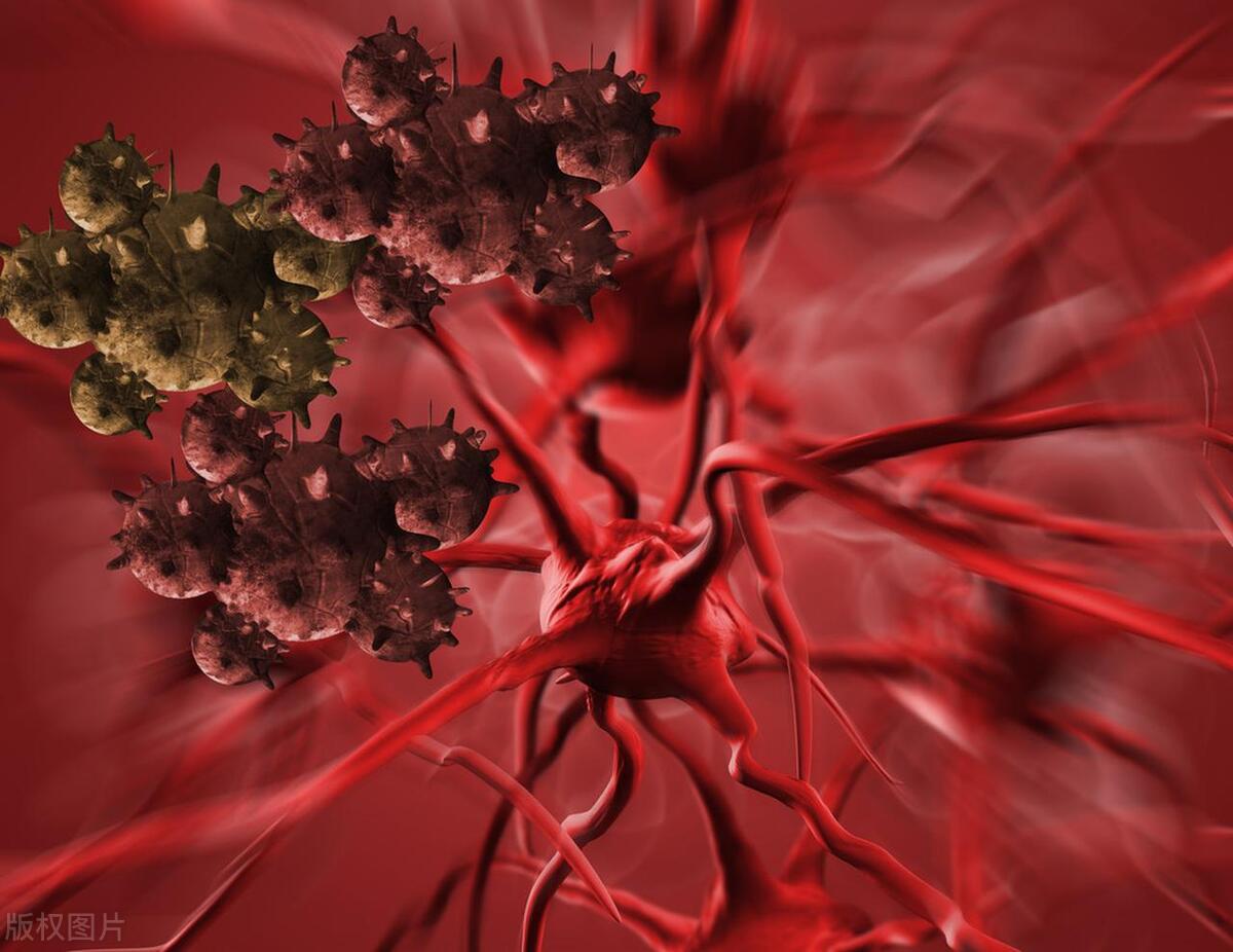 治疗鳞状细胞癌的偏方,75岁老人患鳞癌怎么治