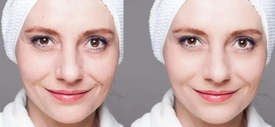 腿上毛孔堵塞有硬块怎么解决,有没有解决毛孔堵塞的身体乳