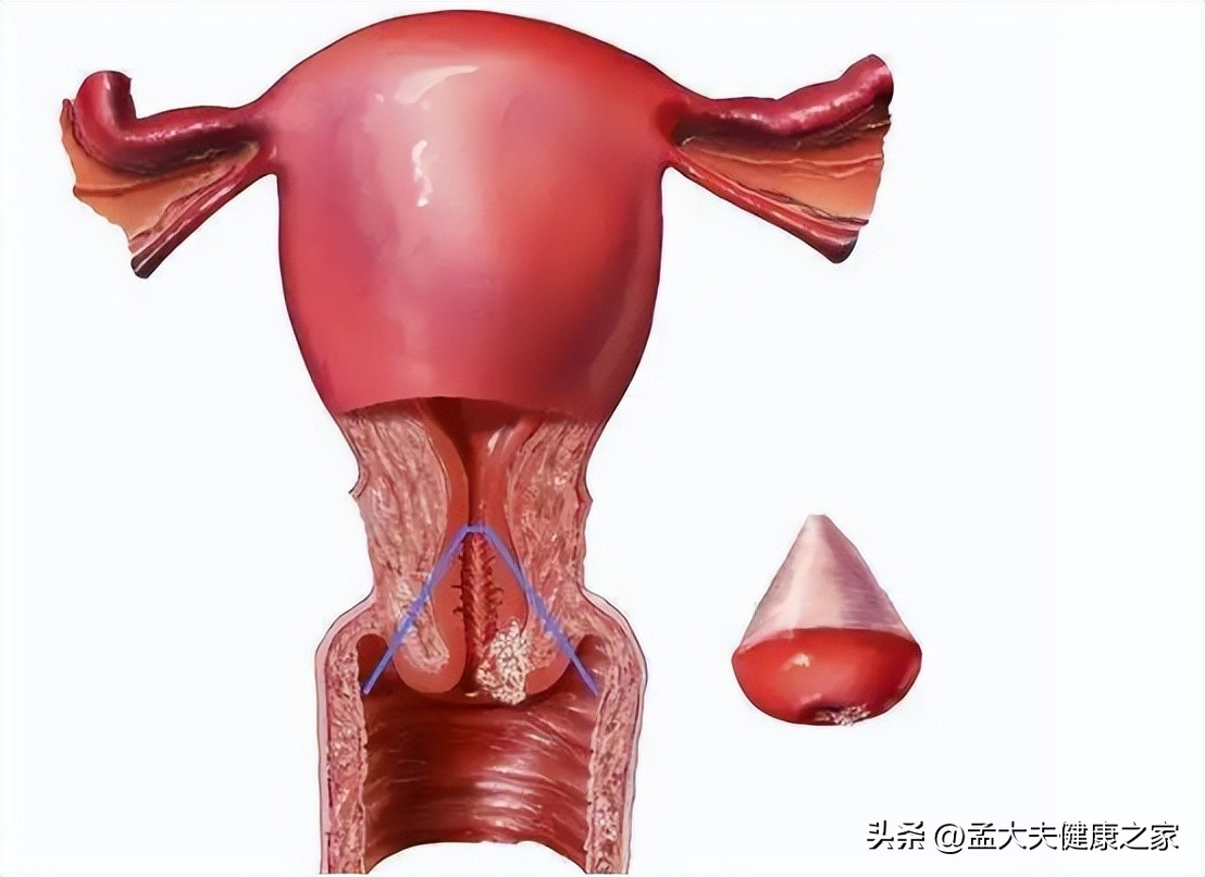 宫颈肥大的原因和危害严重吗,检查宫颈肥大是怎么回事