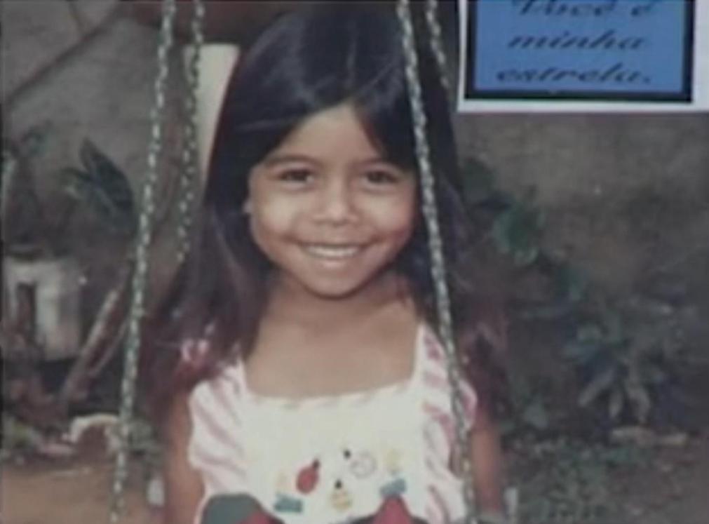 1987年巴西窃贼偷了一胶囊，手部溃烂，医生说只是过敏，后被截肢