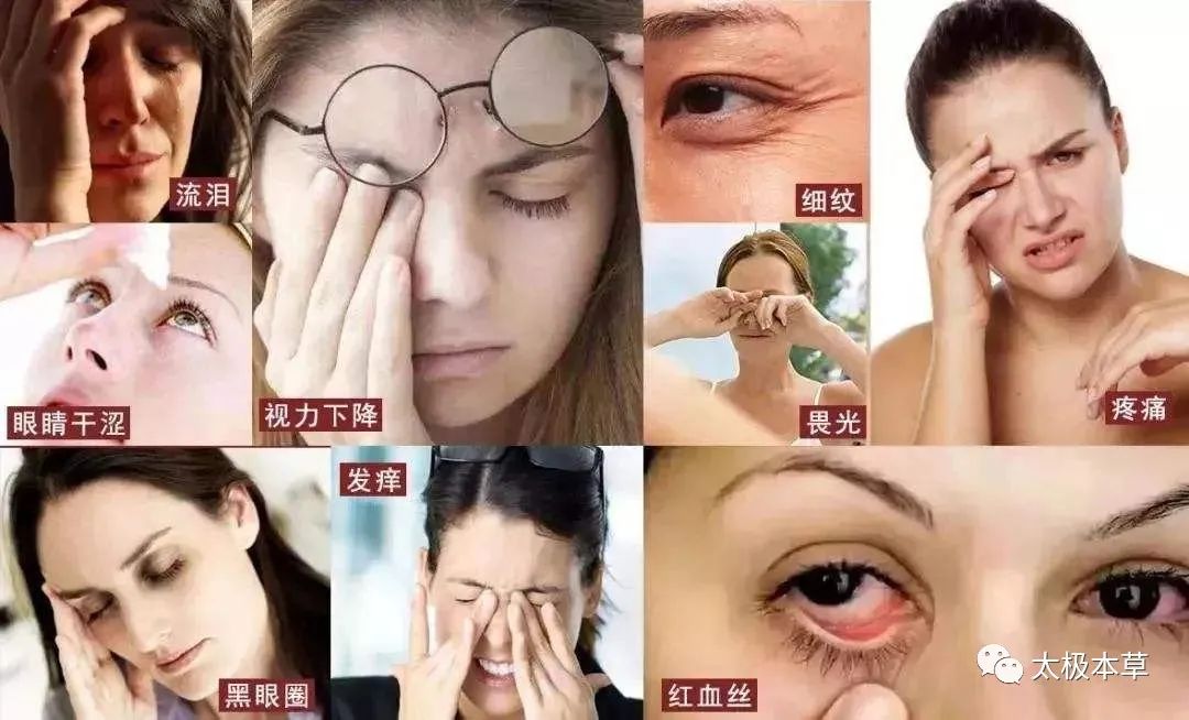 用眼过度怎么缓解吃什么,看电脑用眼过度怎么缓解