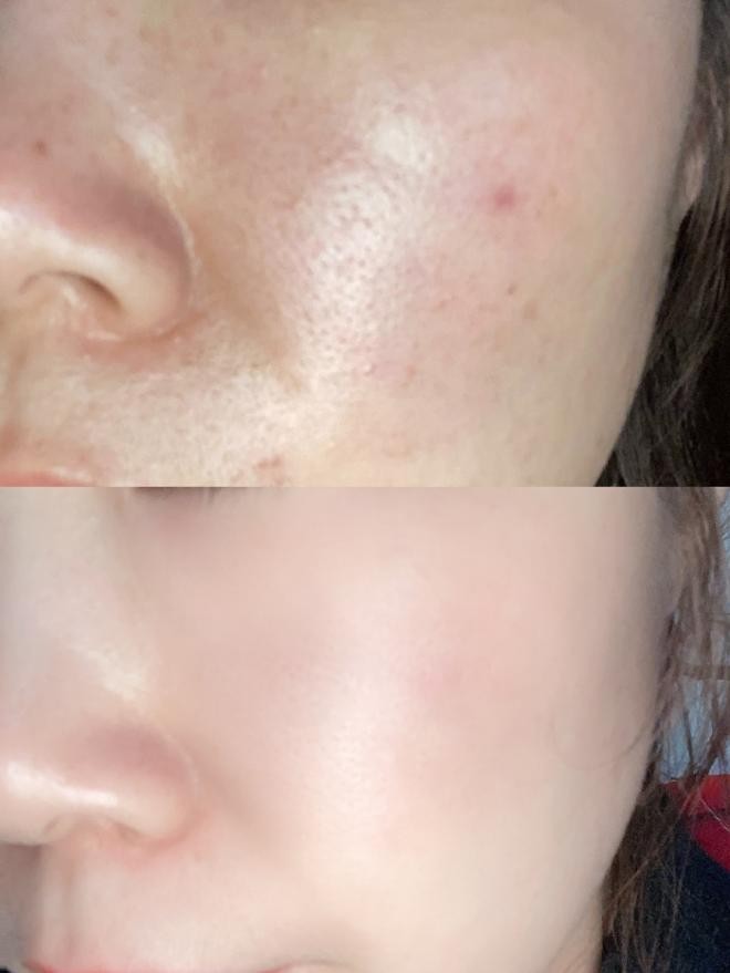 孕妇叶酸护肤品,孕妇专用叶酸护肤品