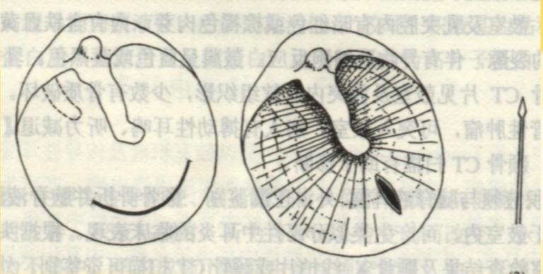 爱耳小知识,爱耳日科普