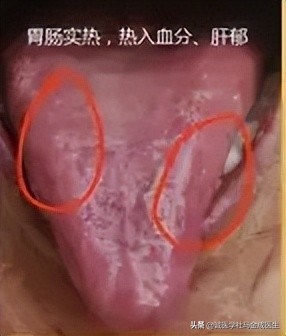 吃六味地黄丸上火？什么人不适合吃六味地黄丸？怎么吃不上火呢？