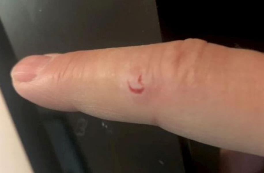 英国嗜血松鼠2天咬伤18人咬到出血!最终被抓起来安乐死