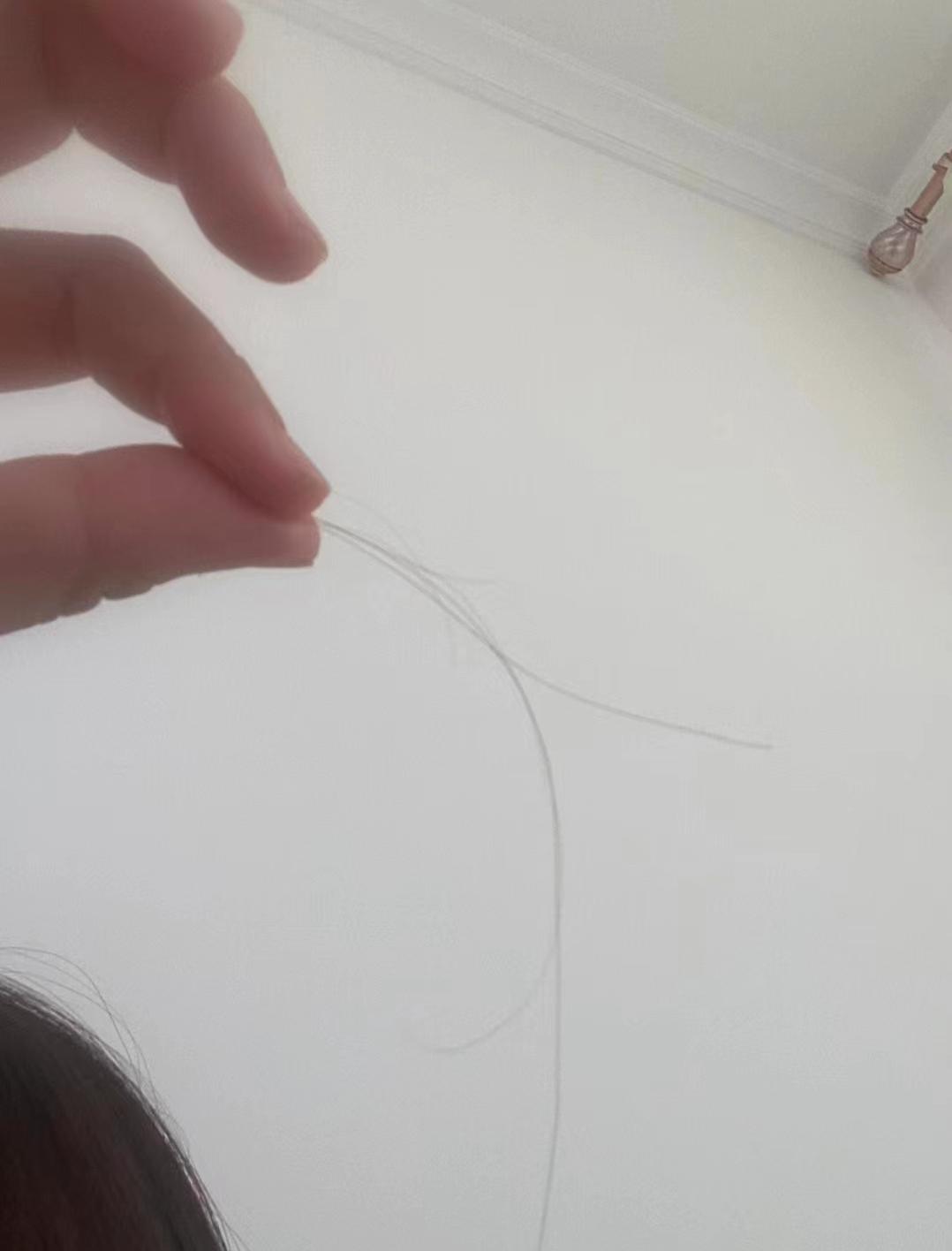 米诺地尔打卡第五天,米诺地尔每日打卡