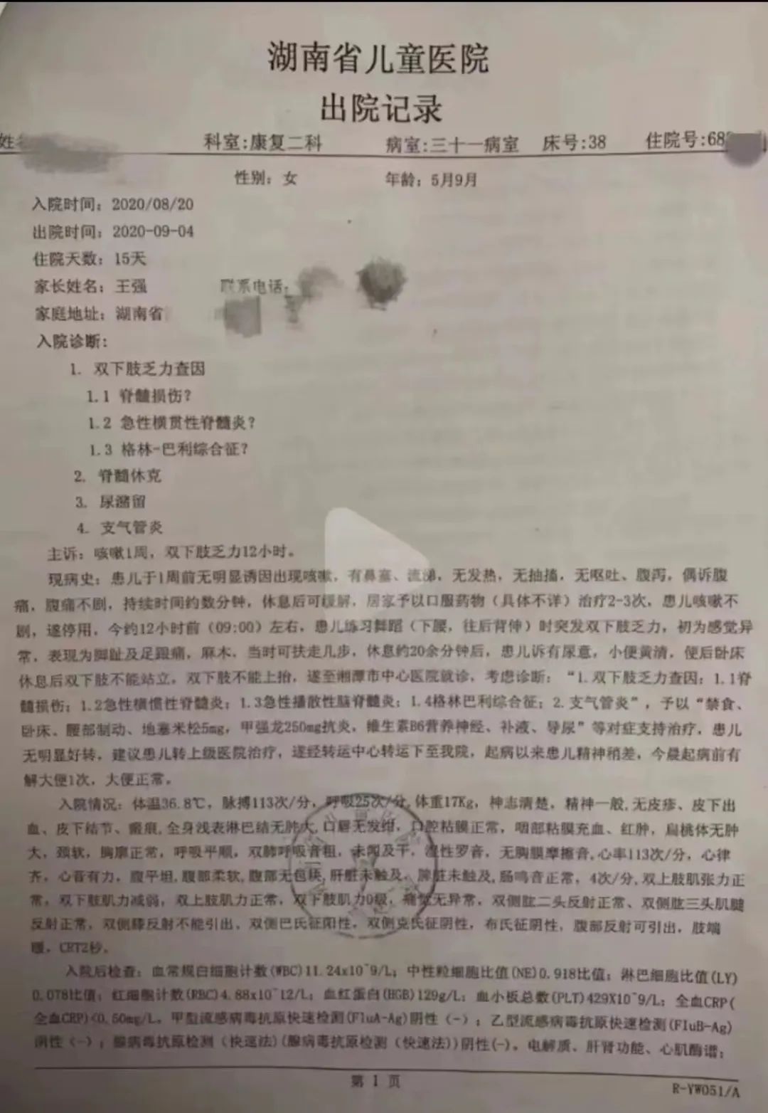 小孩子学舞蹈下腰是不是很危险 (幼童学舞下腰的危害)
