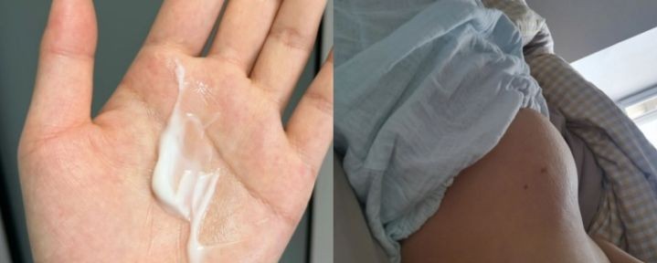 妊娠油和妊娠霜哪个更好用,妊娠纹用什么护肤霜比较好