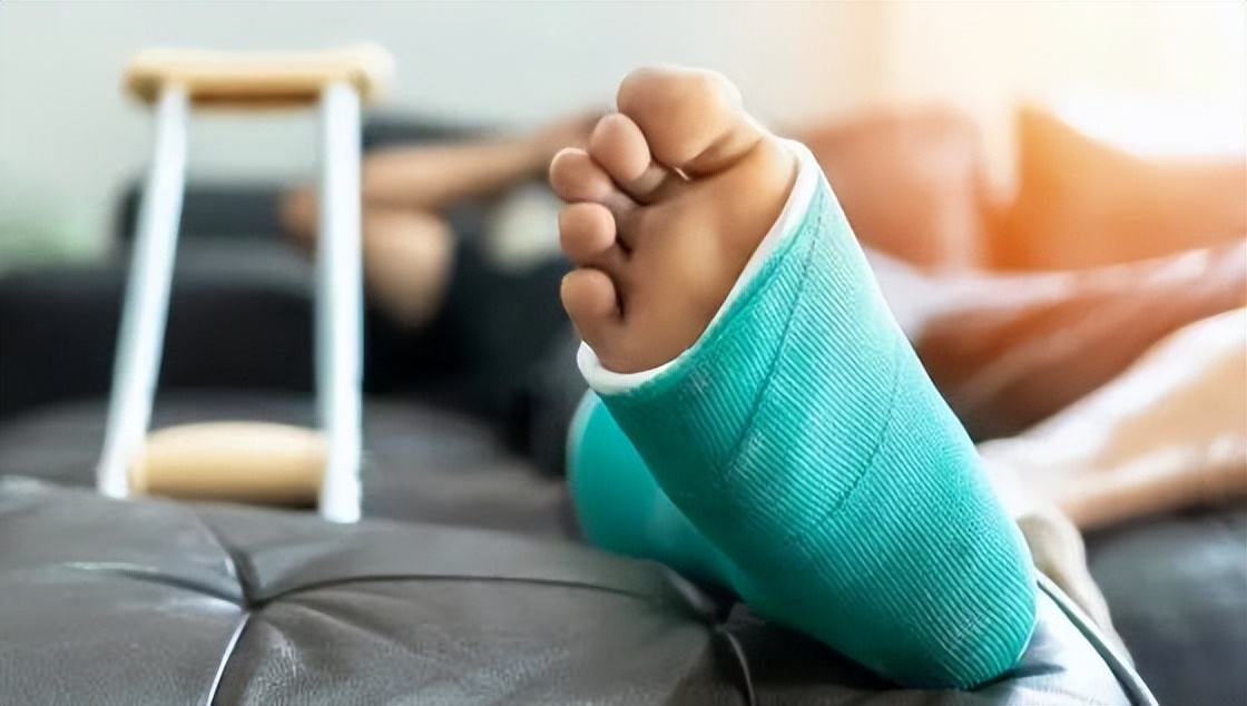 骨折后一直不消肿是怎么回事,骨折后骨头不长是缺少元素