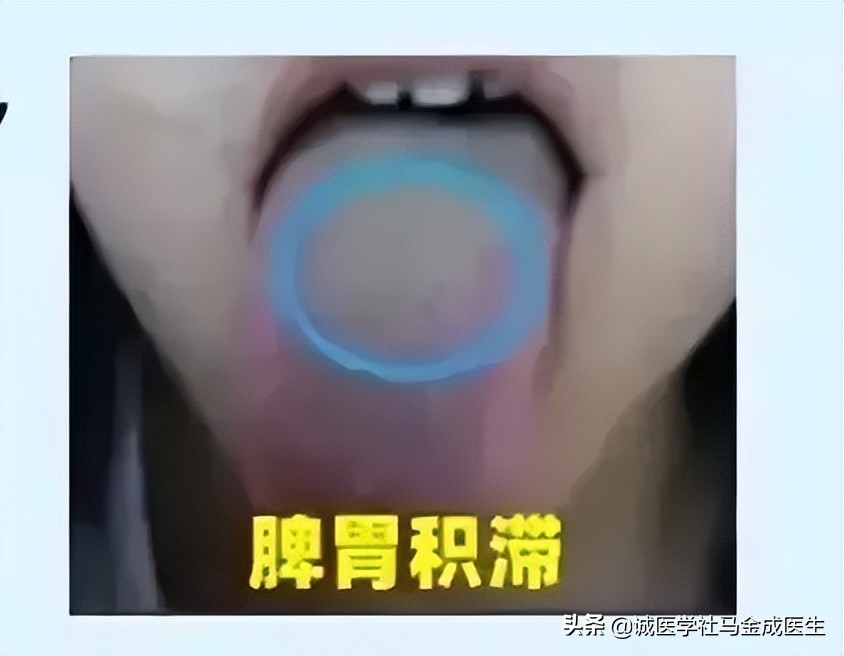 5岁小孩脾胃差吃什么中成药调理,脾胃肝肾肺亏损全部调理的中成药