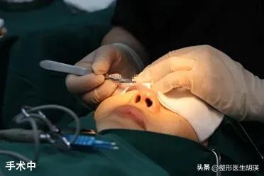 做双眼皮20天大小眼,做双眼皮二十几岁做最好